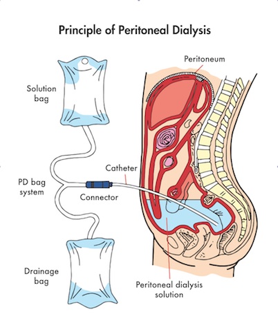 davita dialysis middle roswell ga