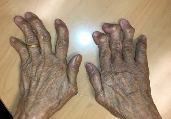 Common hand conditions