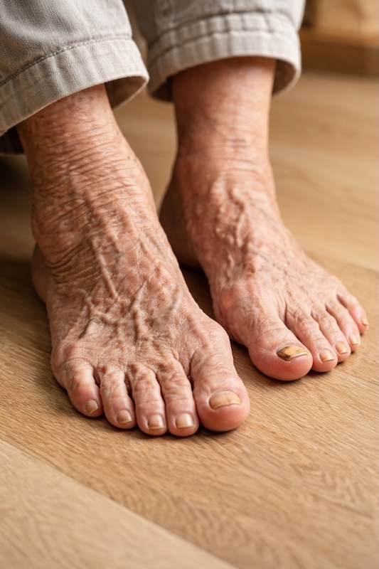 Healthy feet, active life